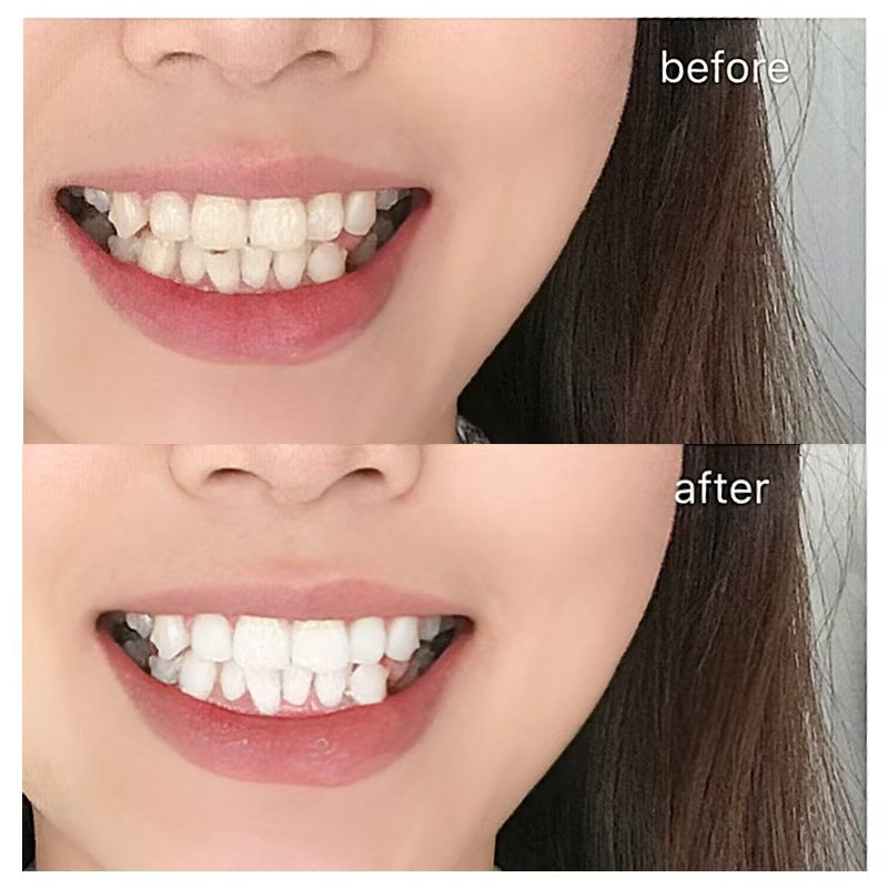 Whitening strip